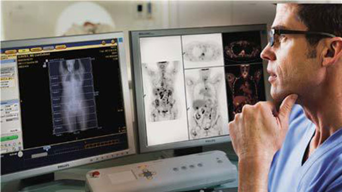 Examining the value of digital PET/CT thumbnail