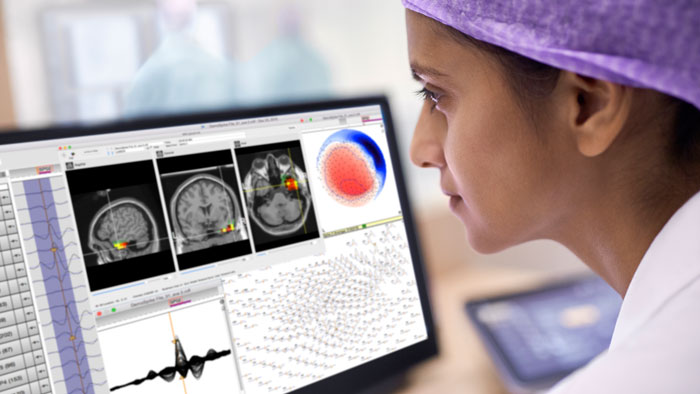 Presurgical planning