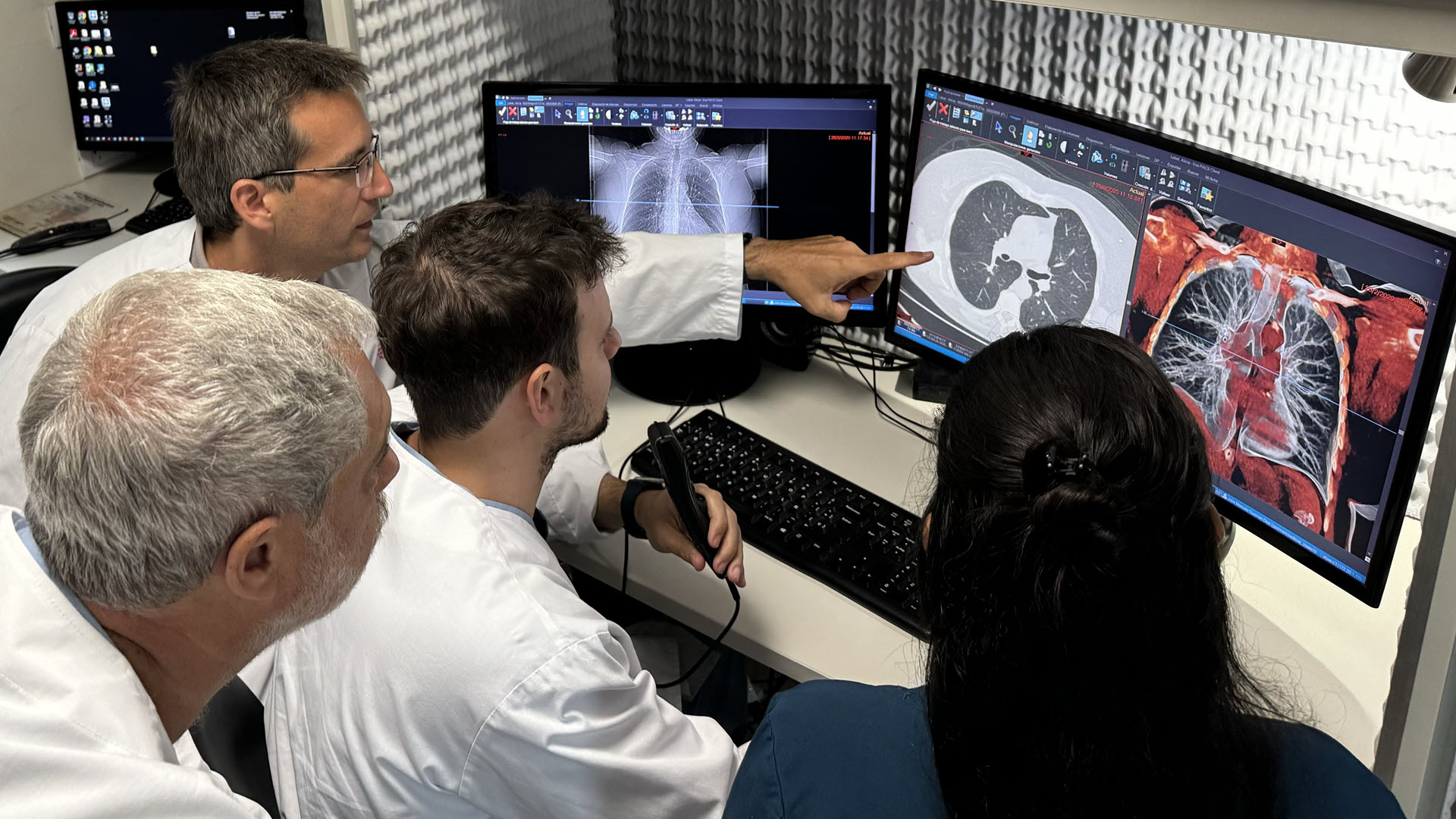 Teleradiology initiative for early lung cancer detection in remote regions of Argentina