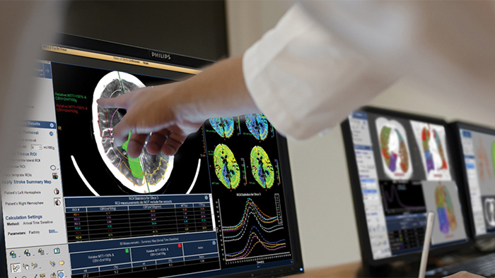 Philips radiology workflow solutions