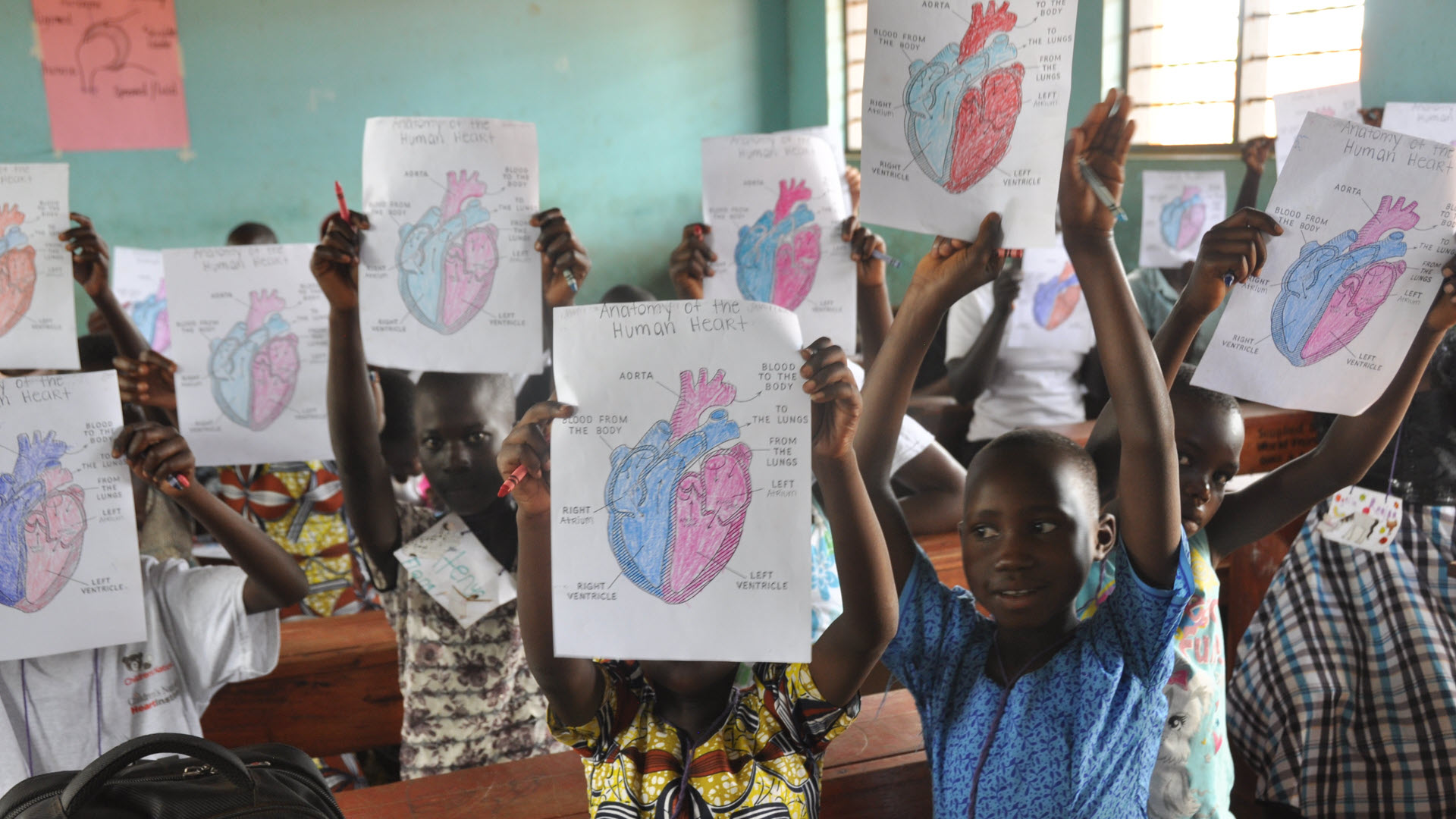 Rheumatic heart disease screening program in Uganda